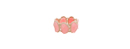 Pink and Gold Druzy Stretch Bracelet